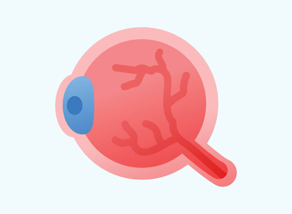 망막색소상피(RPE) 세포 확대 구조, 아연이 가장 많이 축적되는 눈 조직